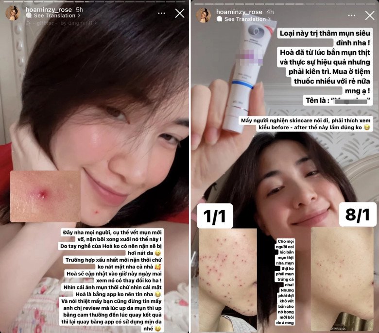 Người giàu xài kem dưỡng da 42 triệu chỉ để cấp ẩm, nhiều người đẹp Vbiz dùng mỹ phẩm giá vài trăm nghìn - 4