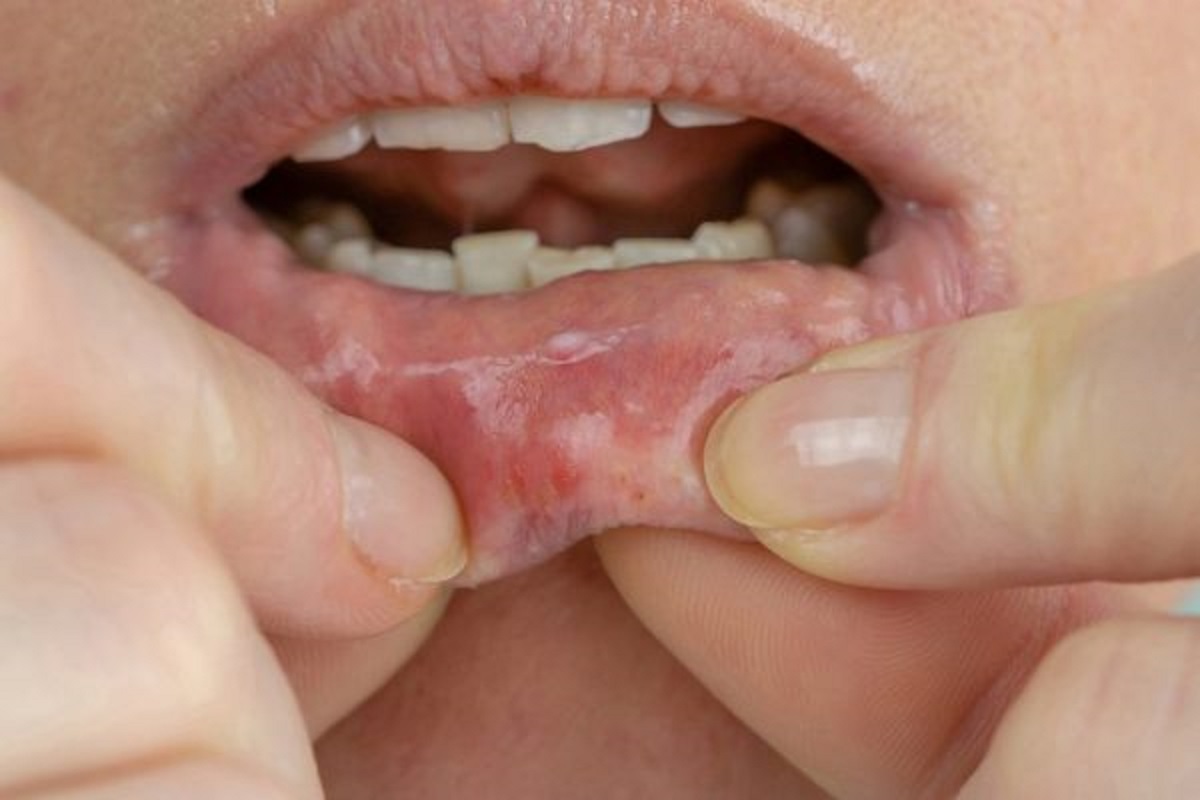 17 dấu hiệu cho thấy tế bào ung thư đang tăng vọt được thể hiện trên cơ thể - 11