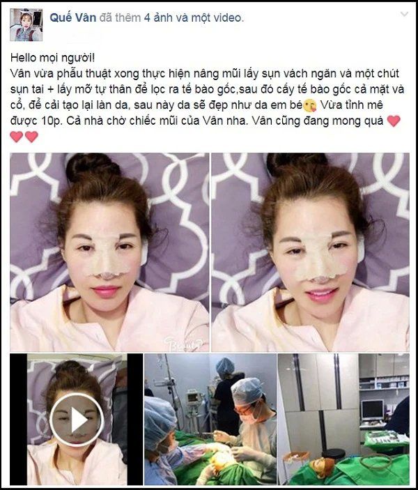 Hồ Ngọc Hà tiết lộ phương pháp giúp &#34;trẻ mãi không già&#34;, hội sao Vbiz tuổi nào cũng áp dụng - 9