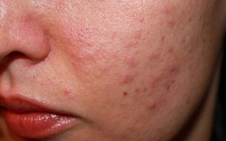 3,8 tỷ lượt tìm kiếm bước skincare chị em thường bỏ qua, bảo sao da khô sần, chăm dưỡng vẫn chưa đẹp - 5
