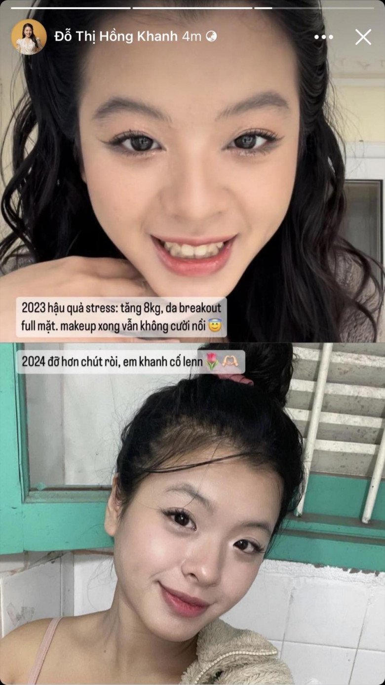 Con gái cá tính của Chiều Xuân dũng cảm khoe ảnh mặt mộc, làn da từng &#34;toang&#34; nặng vì 1 lí do - 5