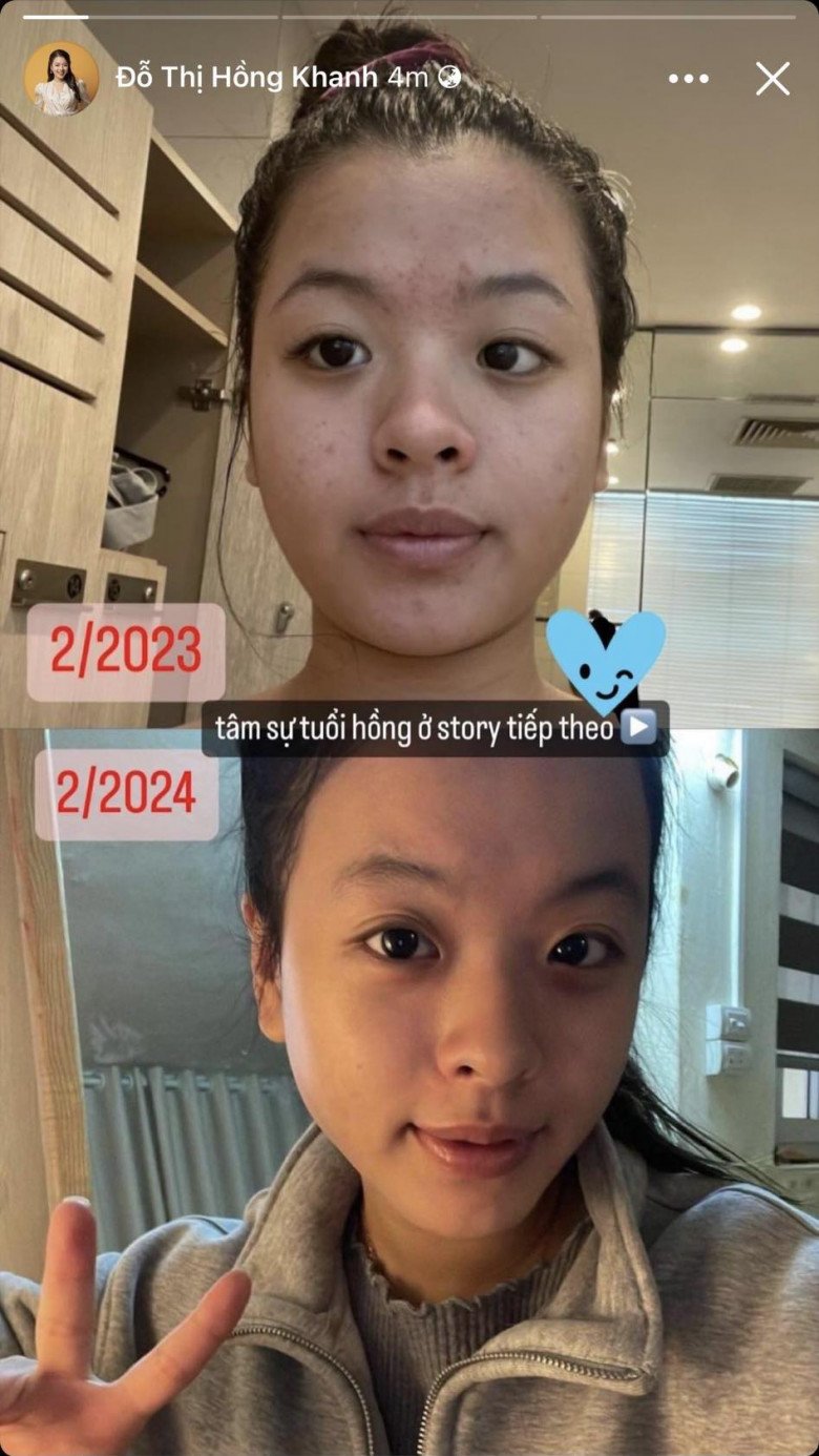Con gái cá tính của Chiều Xuân dũng cảm khoe ảnh mặt mộc, làn da từng &#34;toang&#34; nặng vì 1 lí do - 4