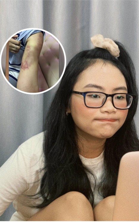 Phương Mỹ Chi - Thiện Nhân: Sắc vóc hiện tại của 2 ca sĩ nhí từng khủng hoảng cân nặng giờ ra sao? - 9