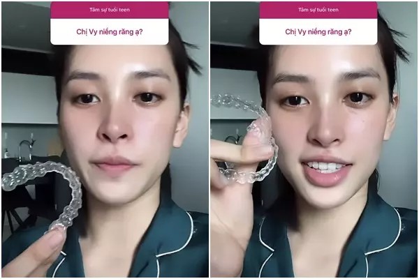 Bạn gái tin đồn của HIEUTHUHAI từng có quá khứ &#34;đeo niềng sắt&#34;, giờ đẹp ngoạn mục như Bảo Thy, Hòa Minzy - 10