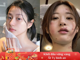 Còn 14 ngày nữa tới Tết, chị em cần bỏ ngay bước chăm da này nếu không muốn làn da "xuống dốc không phanh"