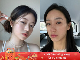 Tránh xa những thói quen ngày Tết nếu không muốn da nhăn nheo và cả năm chăm da hoá "công cốc"