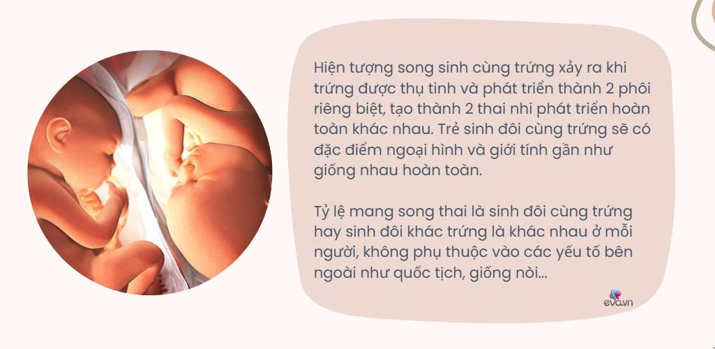 Ca sinh 3 đặc biệt: 2 bé gái là cặp song sinh cùng trứng, cả 3 đều nặng hơn 2,3kg - 6