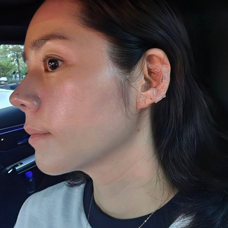 Mỹ nhân đẹp tự nhiên hoàn hảo nhất showbiz, mặt mộc không &#34;góc chết&#34;, chống lão hóa với quy tắc &#34;3-3&#34; - 5