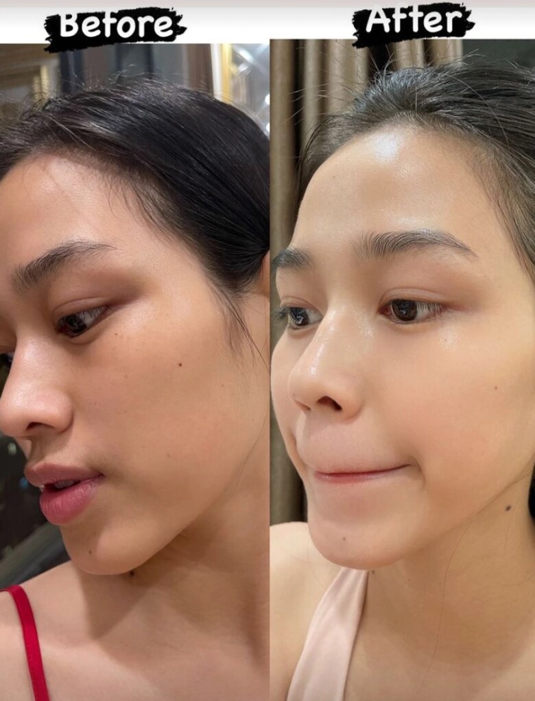 4 loại thực phẩm là &#34;máy bơm siêu dưỡng chất&#34;, càng ăn càng trẻ hóa làn da được nhiều sao Việt tin dùng - 2
