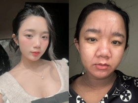 Gái Việt 2k4 mặt mộc xinh như hot girl, giờ có bầu nhan sắc biến dạng gây choáng, tự nhận già đi 20 tuổi