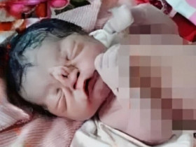 Tái mặt vì con mới sinh ngoại hình khác lạ, bác sĩ nói nguyên nhân bố mẹ ôm nhau khóc