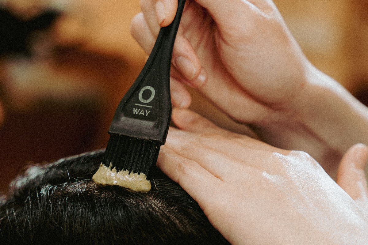 Rụng tóc ở nam: Khi da đầu cần được chăm sóc đúng cách - 2