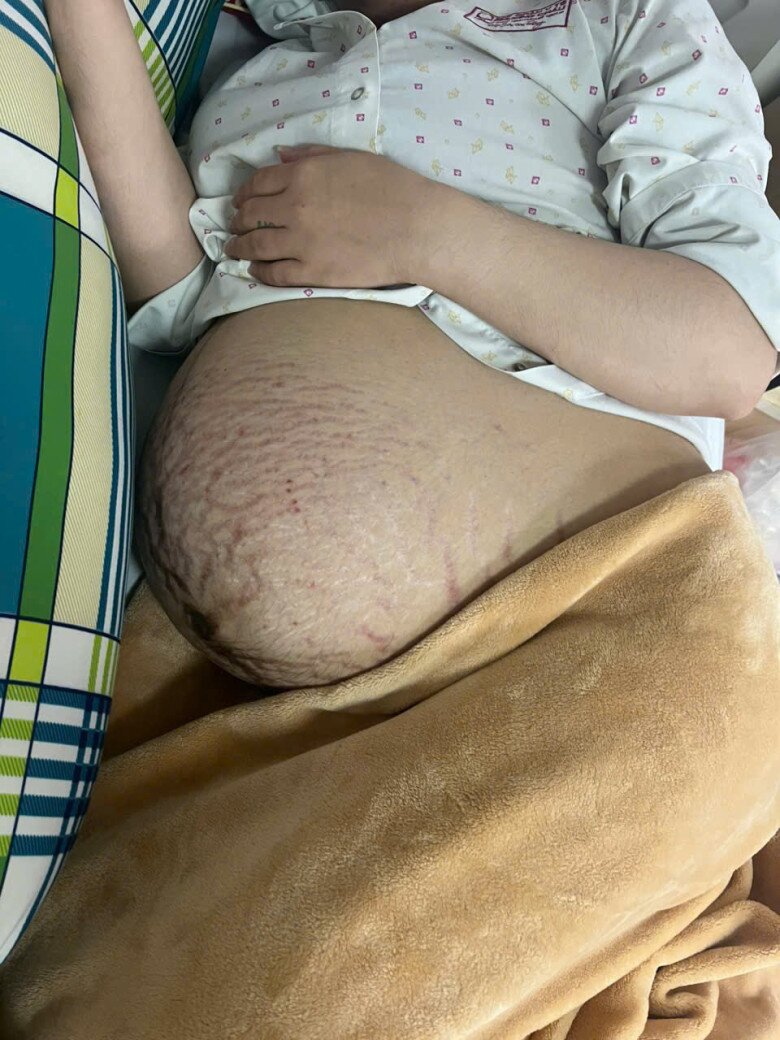 Vượt nỗi đau mất con, Gen Z An Giang vỡ oà mang tam thai, 2 công chúa 1 hoàng tử sau 5 năm chờ đợi - 3