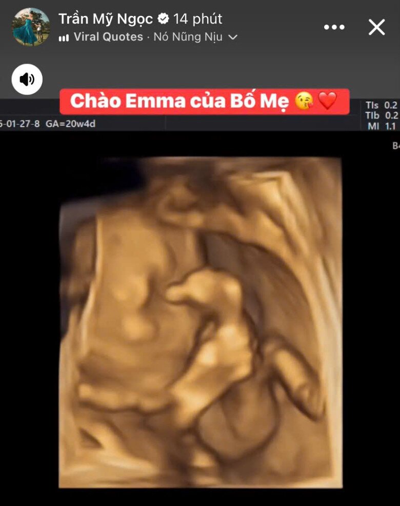 Va phải "sít rịt" ở sân golf, hot girl Đà Lạt được bạn trai tặng 15 sổ tiết kiệm, dính bầu 2 lần trong 2 năm - 2