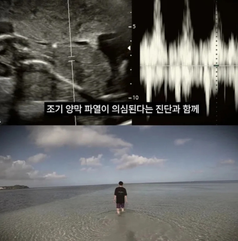 Mỹ nhân phim giờ vàng đau đớn báo tin mất con, lấy chồng nhưng không dám đăng ký kết hôn, 40 tuổi chưa được làm mẹ - 6