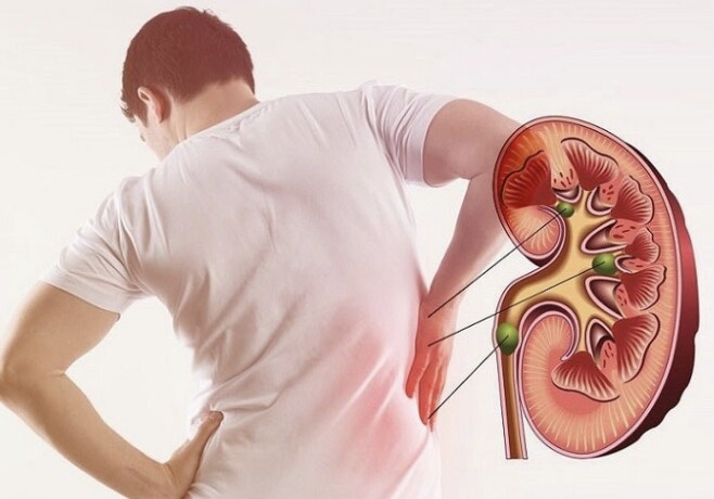 4 dấu hiệu trên tay cảnh báo thận bị tổn thương, ai đang có nên kiểm tra, đừng chủ quan rồi ân hận - 1