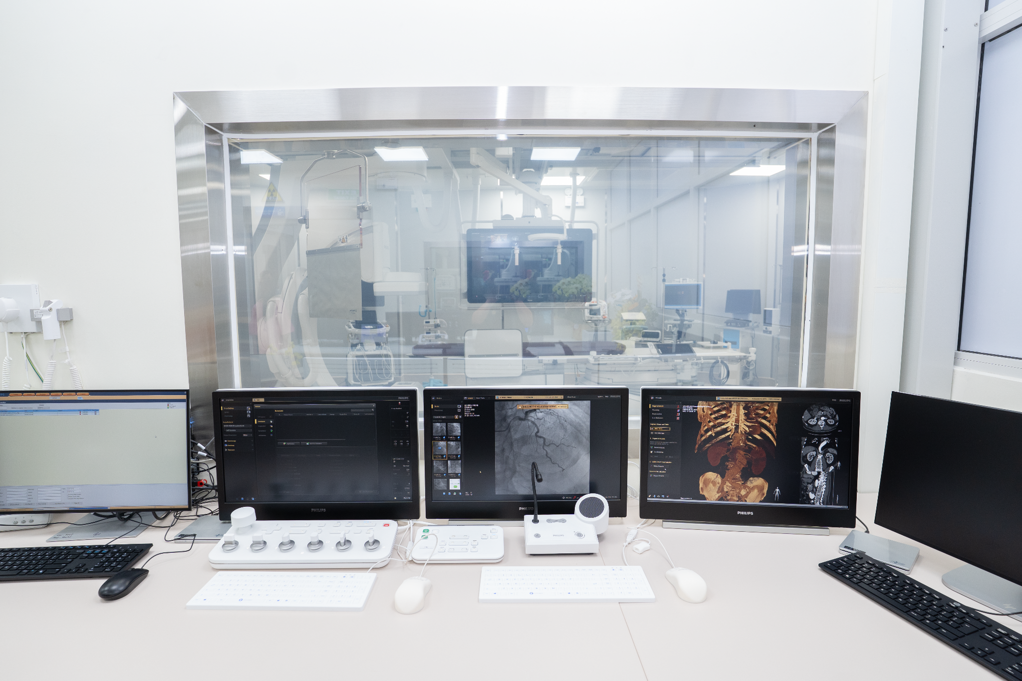 Hệ thống thông tim hiện đại nhất phía Nam được kích hoạt, mở ra chương mới cho chẩn đoán, điều trị bệnh tim - 2