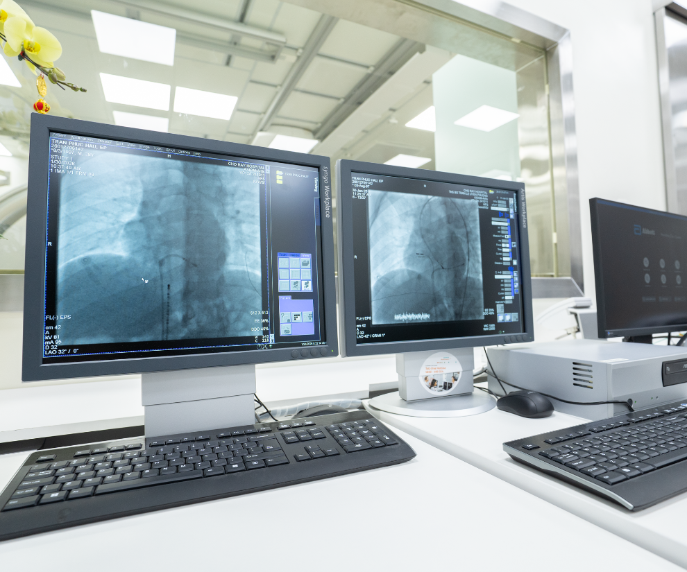 Hệ thống thông tim hiện đại nhất phía Nam được kích hoạt, mở ra chương mới cho chẩn đoán, điều trị bệnh tim - 1