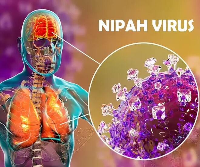Bộ Y tế khuyến cáo nóng tới người dân về virus Nipah: Bệnh có thể lây qua những nguồn nào? - 1