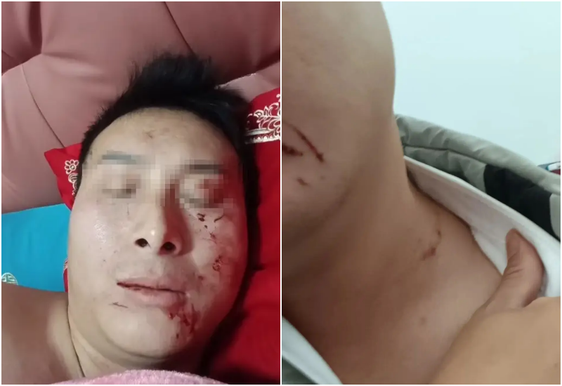 Đêm tân hôn bị vợ cào xước mặt, chồng sững sờ khi phát hiện bí mật vợ giấu trong tủ - 2