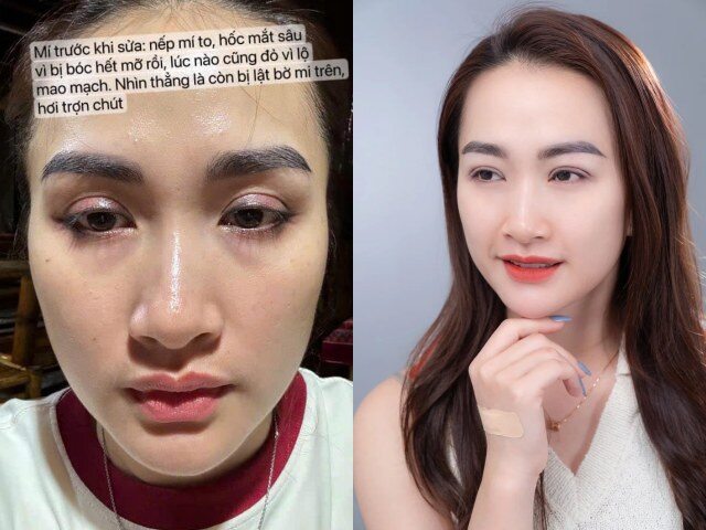 Hot girl dân tộc Thái khiến "nam thần VTV" say đắm phải "cưới vội", nhan sắc 10 năm trước suýt không nhận ra - 4