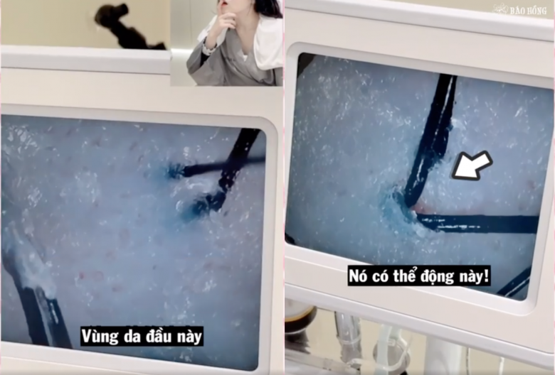Đi gội đầu, gái xinh bị &#34;hét giá&#34; 10 triệu, xem quy trình mới &#34;nổi da gà&#34; vì bấy lâu toàn hành hạ tóc - 1