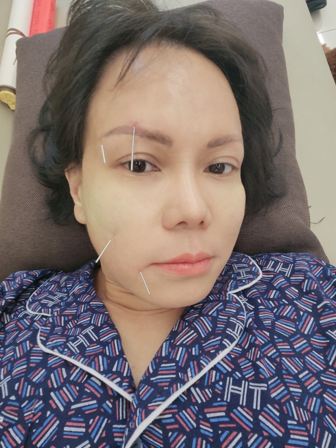 Việt Hương lo lắng vì gương mặt méo khác lạ, biết lý do ai cũng xót xa và cảm phục - 3