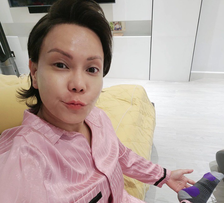 Nữ nghệ sĩ hài méo mặt phải chữa dài ngày, bác sĩ chỉ ra &#34;thủ phạm&#34; là việc rất nhiều người dễ mắc - 1
