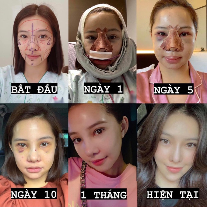 Từng "đập hết mặt" xây lại, Lưu Đê Ly giờ khoe mẹ, ai nấy "bừng tỉnh" với vẻ đẹp cội nguồn - 6