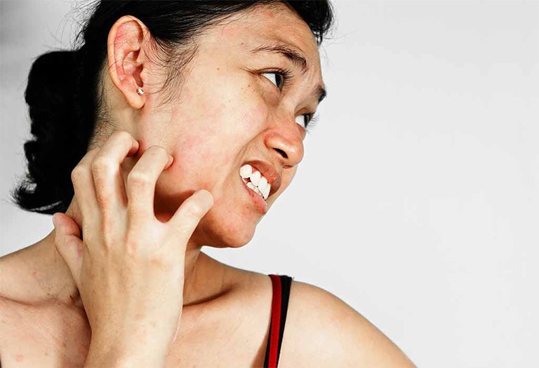 5 dấu hiệu &#34;cầu cứu&#34; của làn da khi dùng sai mỹ phẩm, chị em cần sửa ngay kẻo chưa già đã lão hóa - 4