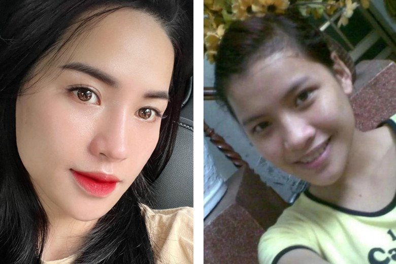 Thoát mác hai lúa, “chiến thần” Võ Hà Linh từng 2 lần “trùng tu” nhan sắc, số tiền bỏ ra chẳng là bao - 9