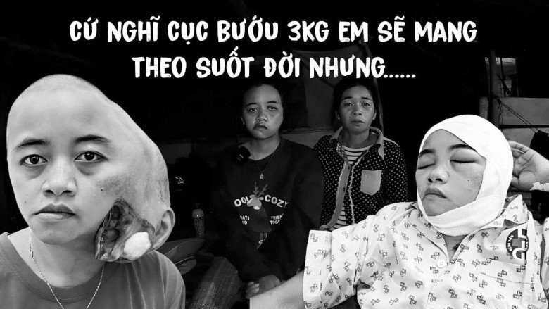 Cô gái trẻ được cha mẹ đặt cho cái tên hàm ý rất xinh đẹp nhưng không may sở hữu &#34;mặt quỷ&#34; và phép màu diệu kỳ khiến tất cả vỡ òa - 1