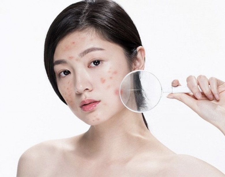 Nên hay không đắp mặt nạ dưỡng da từ sữa tươi không đường? Câu trả lời khiến chị em "vỡ lẽ" - 6