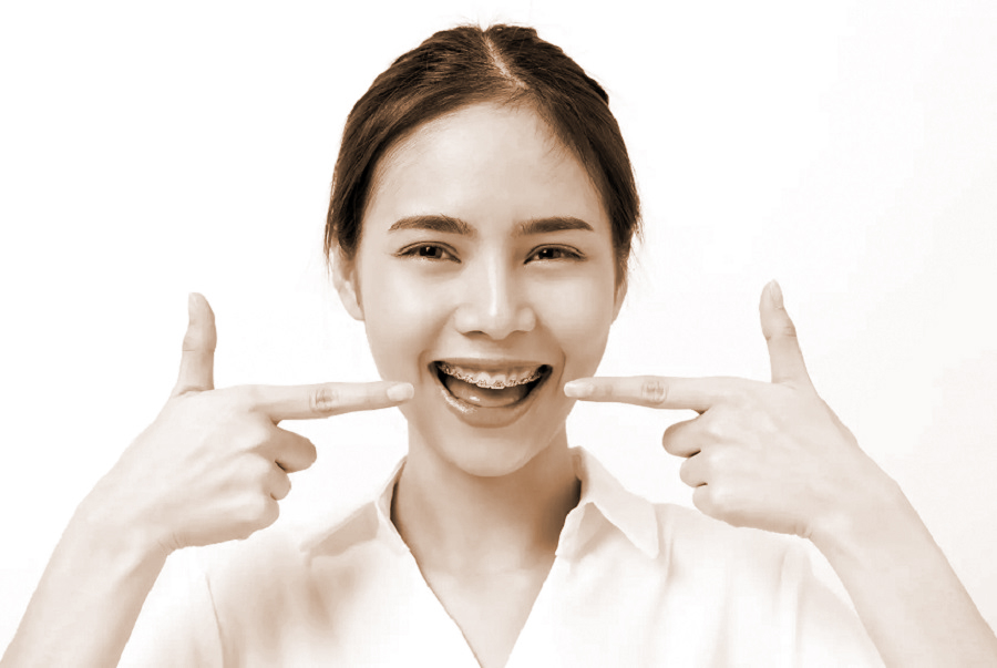 Niềng răng và lưu ý chăm sóc răng miệng - 1
