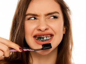 Răng ngả vàng kém duyên, lưu ngay 7 mẹo hay giúp răng luôn trắng sáng đều màu với giá siêu rẻ lại an toàn tuyệt đối
