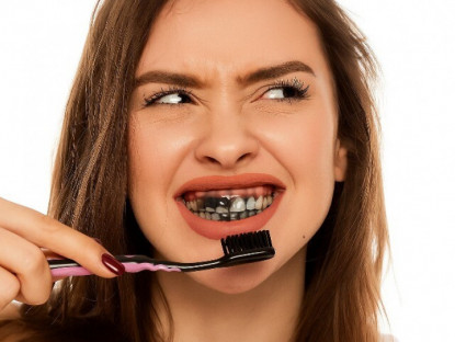 Răng ngả vàng kém duyên, lưu ngay 7 mẹo hay giúp răng luôn trắng sáng đều màu với giá siêu rẻ lại an toàn tuyệt đối