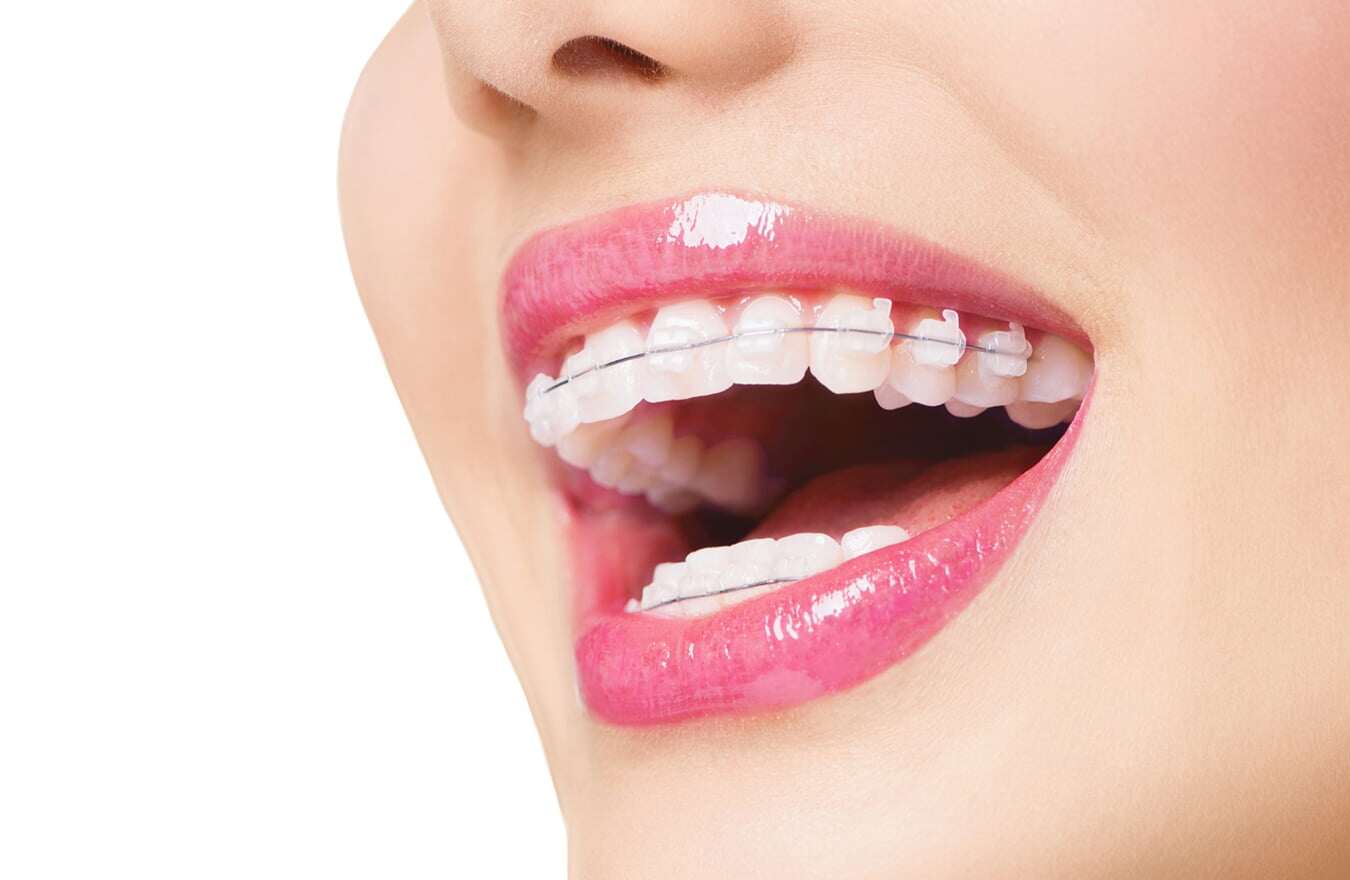 Phương pháp làm đẹp được công khai ở các cuộc thi nhan sắc, hầu như ai ứng dụng cũng đều đăng quang! - 1