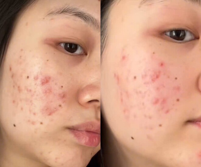 Món ăn được đồn giúp da sáng mịn có gì khiến chị em tranh cãi, người khen ngon, người chê &#34;không nuốt nổi&#34; - 4