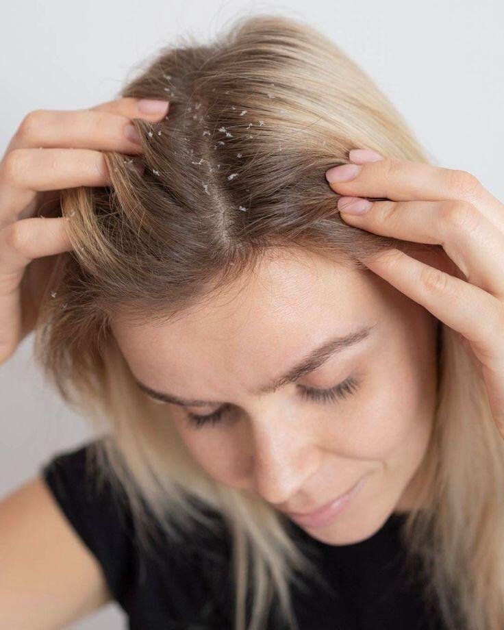 Tẩy tóc bằng oxy già có hiệu quả và lành tính như lời đồn? Chị em lưu ý để tránh phá hủy mái tóc đẹp - 7