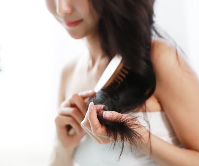 Giảm cân mà tóc rụng như mưa: 7 cách cứu nguy giúp tóc bạn dày mượt như suối mà dáng vẫn đẹp - 1