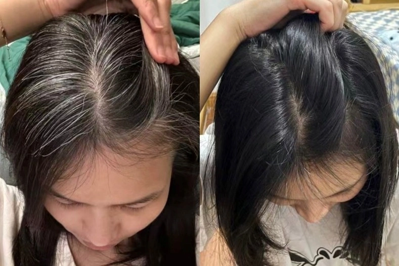 Nhổ tóc không làm giảm đi lượng tóc bạc, chị em áp dụng 5 mẹo sau để tóc đen nhánh và óng mượt như lụa - 4
