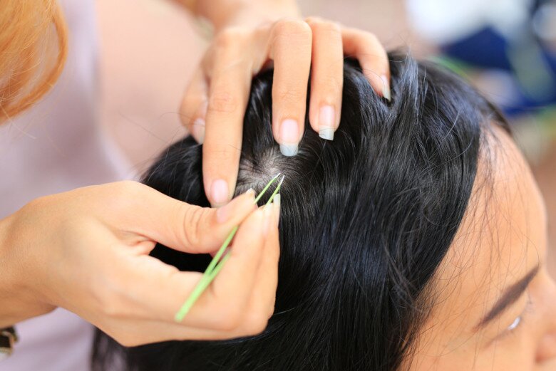 Nhổ tóc không làm giảm đi lượng tóc bạc, chị em áp dụng 5 mẹo sau để tóc đen nhánh và óng mượt như lụa - 3