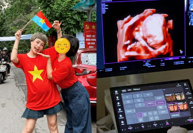 Ca sĩ Ngọc Khuê tiết lộ ngày dự sinh con thứ 2 ở tuổi U50, &#34;em bé khủng long&#34; chưa chào đời đã được cả nhà cưng nựng - 3