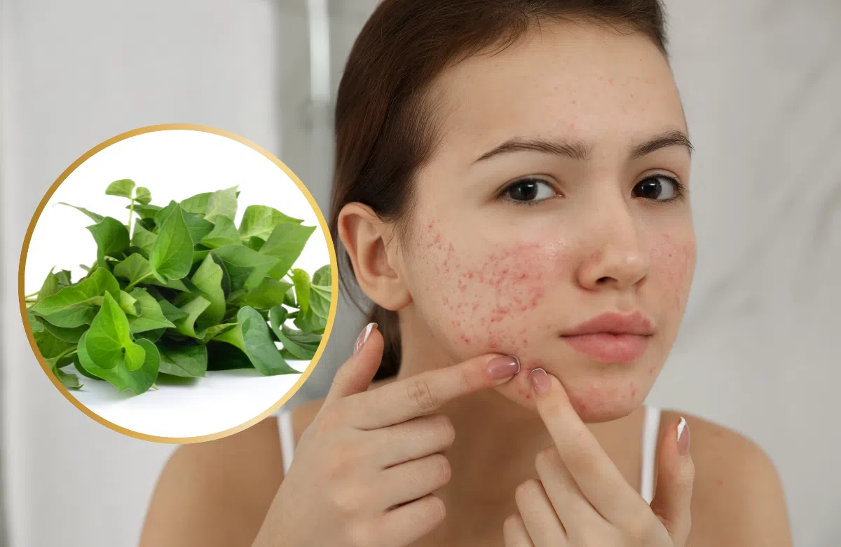 Loại rau giá rẻ bèo ngoài chợ là &#34;thần dược&#34; cho hội chị em: 5 công dụng &#34;đỉnh&#34; từ trị mụn, giảm cân đến điều hòa nội tiết tố - 1