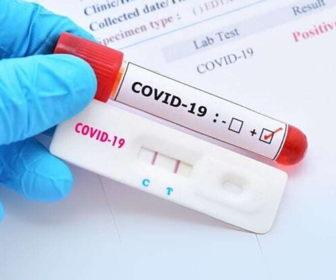 Người mắc COVID-19 gia tăng ở nhiều nước, Việt Nam ghi nhận bao nhiêu ca, Bộ Y tế dự báo và khuyến cáo điều gì? - 1