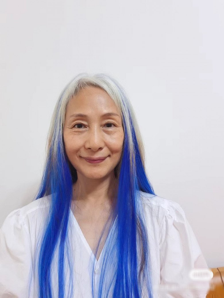 Đâu là giải pháp tối ưu cho người tóc bạc sớm do di truyền?