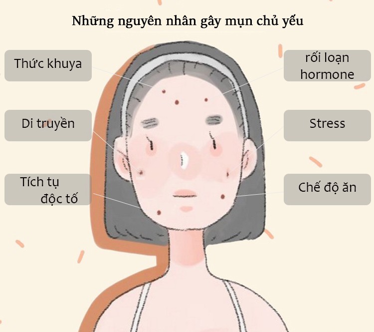 Không phải vì ở bẩn, các chuyên gia cho biết người có mụn nội tiết đều chung thói quen xấu này - 2