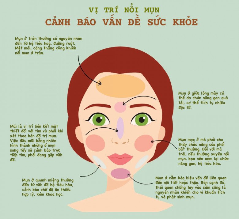 Không phải vì ở bẩn, các chuyên gia cho biết người có mụn nội tiết đều chung thói quen xấu này - 1