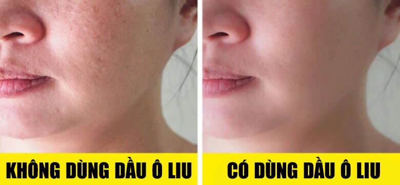 Loại dầu bán đầy chợ giúp lão hoá ngược: Á hậu Huyền My ủ tóc, mỹ nhân đẹp nhất thế giới dưỡng da - 8