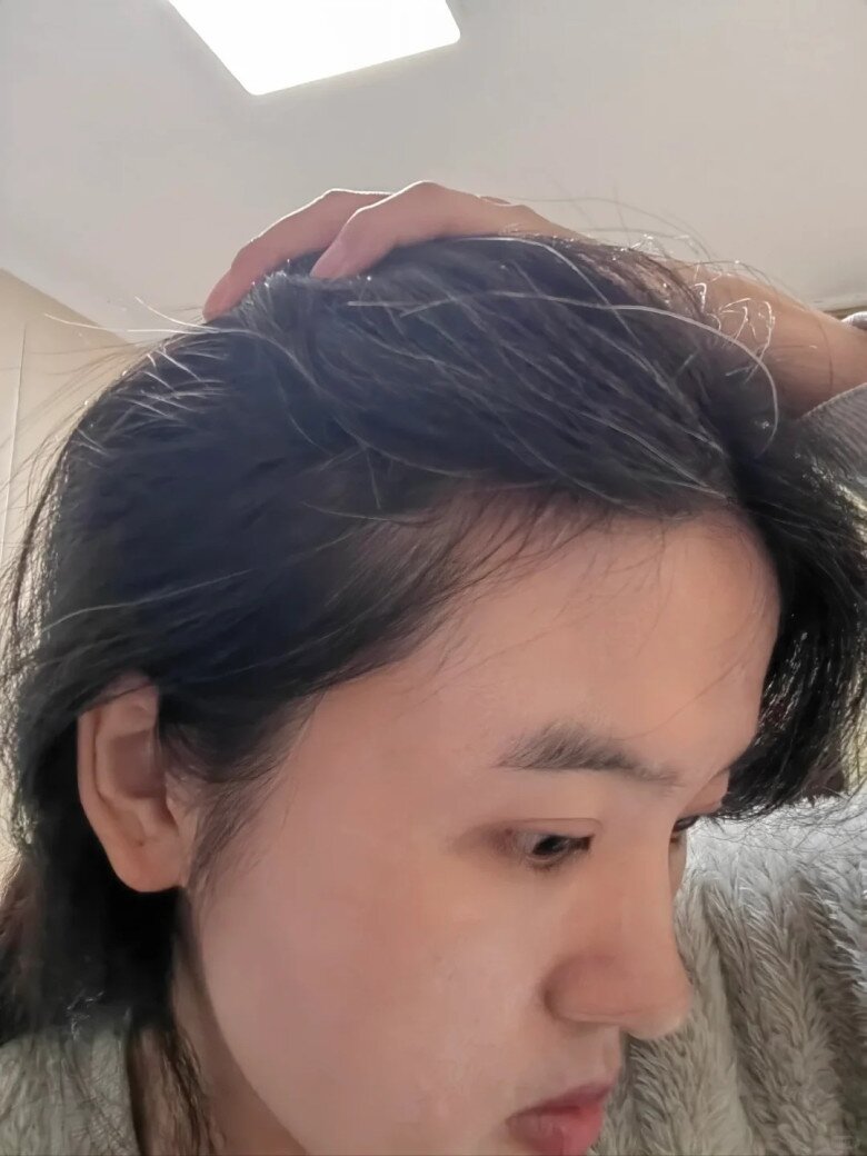 Nhổ tóc không làm giảm đi lượng tóc bạc, chị em áp dụng 4 mẹo sau để tóc đen nhánh và bóng khỏe - 1